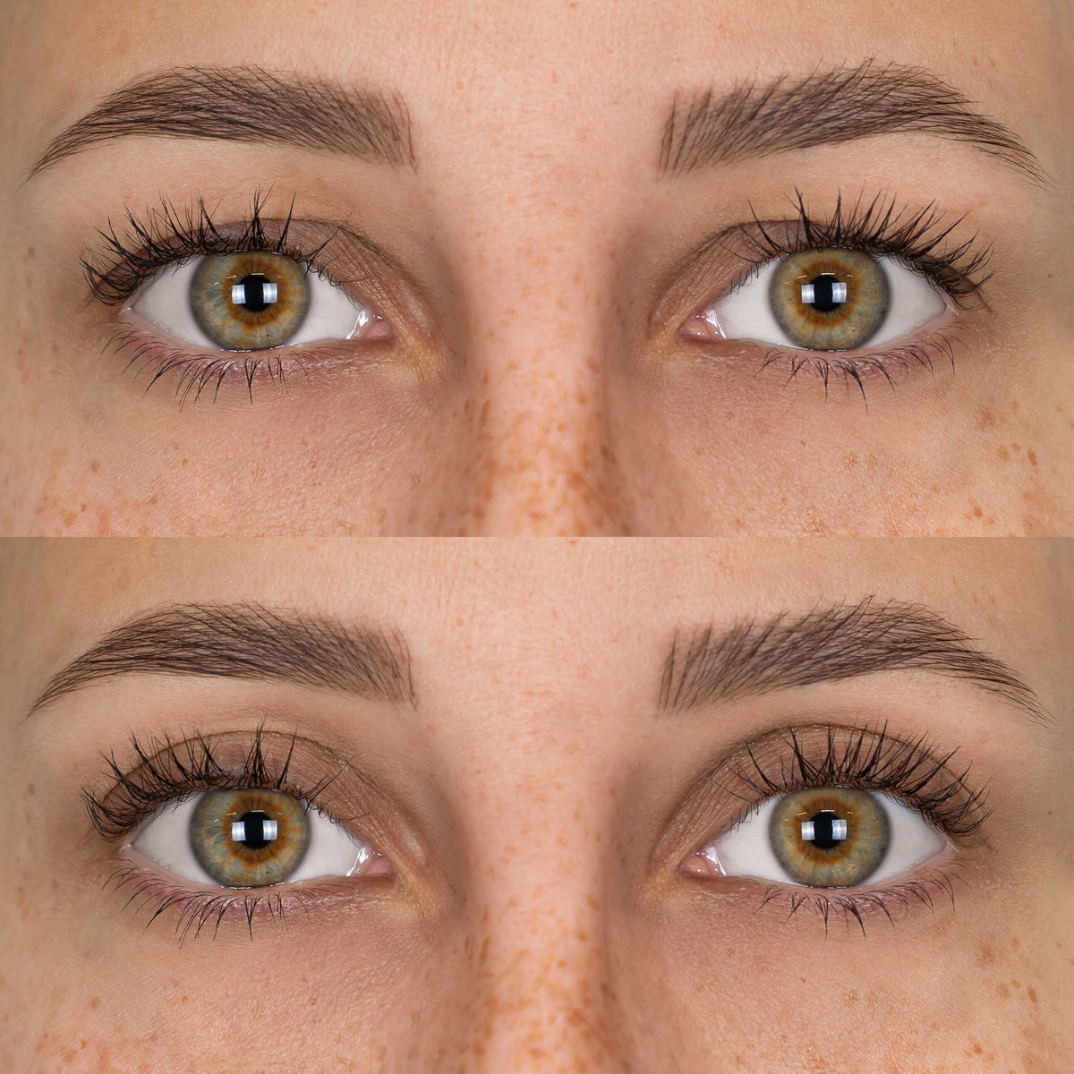 Eyelid Lift Patches